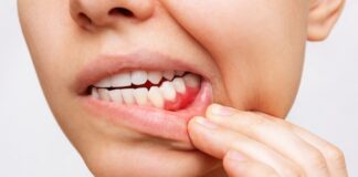 Przyczyna i metody leczenia nadwrażliwości zębów