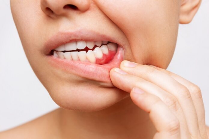 Przyczyna i metody leczenia nadwrażliwości zębów
