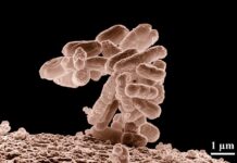 Ile jest ważny pakiet po sterylizacji? Ile jest ważny pakiet po sterylizacji?